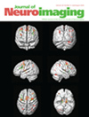 JOURNAL OF NEUROIMAGING期刊封面