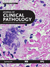 JOURNAL OF CLINICAL PATHOLOGY期刊封面