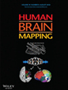 HUMAN BRAIN MAPPING期刊封面